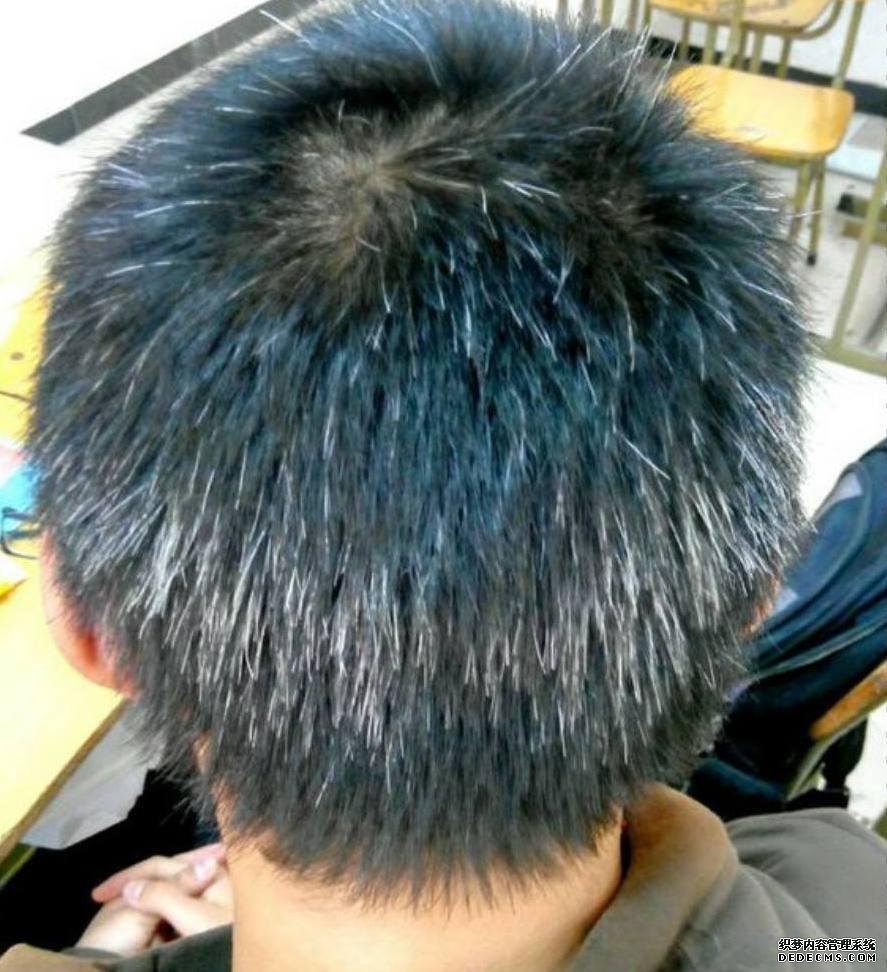 白發(fā)越長越多，并非變老的信號，可能是身體缺乏這3種元素了